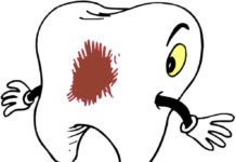 Los consumidores de marihuana son más propensos a sufrir caries y gingivitis Los consumidores de marihuana son más propensos a sufrir caries y gingivitis