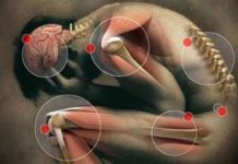 El cannabis puede ser útil en el tratamiento de la fibromialgia según un estudio El cannabis puede ser útil en el tratamiento de la fibromialgia según un estudio