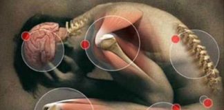 El cannabis puede ser útil en el tratamiento de la fibromialgia según un estudio