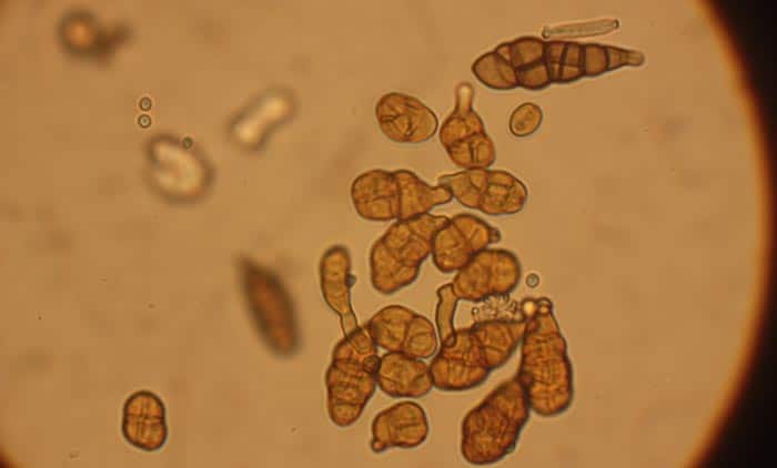 Vista microscópica de un grupo de esporas de Alternaria sp., patógeno responsable de la enfermedad conocida como Alternariosis, Tizón Temprano o Moho Negro.