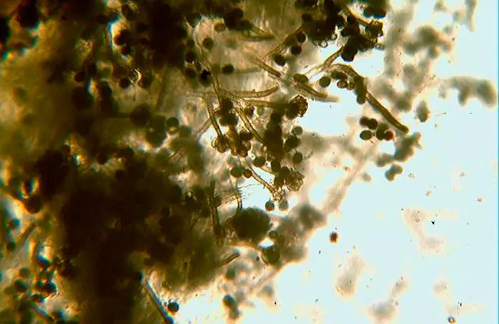 En la foto conidi&oacute;foros y conidios de Botrytis cinerea. Estas esporas vegetativas son las responsables de las infecciones secundarias en los cultivos de interior. 