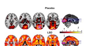Así es el viaje del cerebro a bordo del LSD
