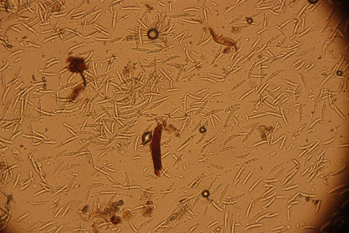 Miles de microconidio y macroconidios de Fusarium vistas con microscopio óptico X400.
