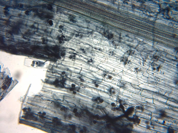 Micorrizas arbusculares vistas con un microscopio