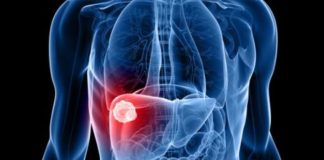 El cannabis puede fortalecer el sistema inmune y combatir el cáncer