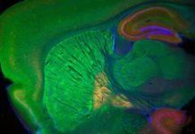 Cannabis y enfermedades neurodegenerativas (III) El cerebro expresa abundantes receptores para cannabinoides