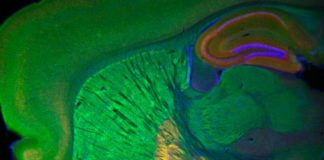El cerebro expresa abundantes receptores para cannabinoides
