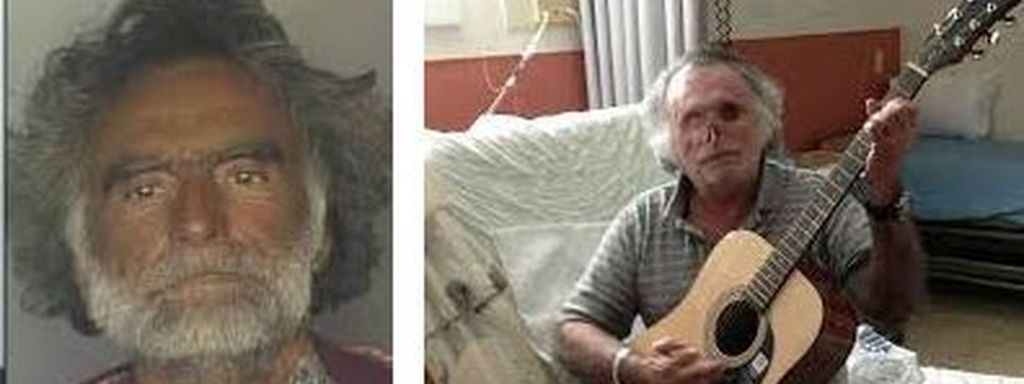 Ronald Poppo, antes y después de que se comiesen el 75% de su cara