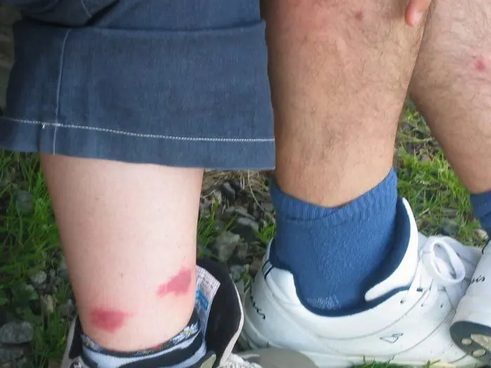 Asi pican los mosquitos en Laponia