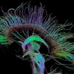¿De dónde vienen las visiones de la ayahuasca y de otros alucinógenos? (II) ¿De dónde vienen las visiones de la ayahuasca y de otros alucinógenos? (II)