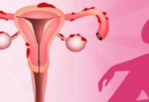 El cannabis puede ser útil en el tratamiento de la endometriosis El cannabis puede ser útil en el tratamiento de la endometriosis