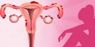 El cannabis puede reducir el dolor en pacientes con endometriosis