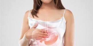 A woman suffering from gastroesophageal reflux disease