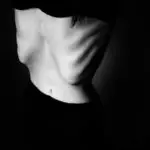 Cannabis y anorexia body