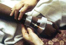 Náuseas y vómitos en quimioterapia Náuseas y vómitos en quimioterapia