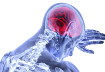 Dolor y cannabis brain, inflammation, stroke
