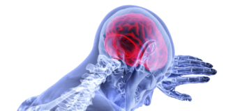 brain, inflammation, stroke