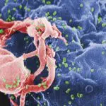 Usos terapéuticos del cannabis: Infección por VIH-SIDA Usos terapéuticos del cannabis: Infección por VIH-SIDA