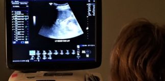 Kidney Ultrasound!