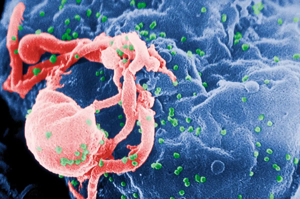 Actualización en ciencia y cannabis: infección por VIH