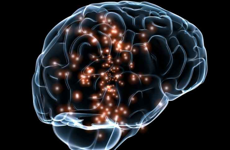 Enfermedades neurodegenerativas y cannabis terapéutico: avances en la esclerosis múltiple El cerebro sigue suponiendo un reto para la ciencia del siglo XXI