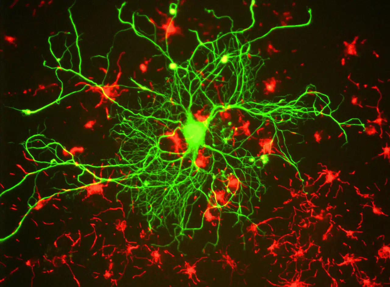 Los axones comunican distintas neuronas en red