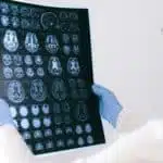 La DMT oral eleva el consumo cerebral de glucosa en voluntarios sanos Profesional sanitario revisa una imagen cerebral en un contexto de investigación neurogenética