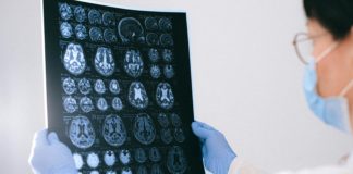 Profesional sanitario revisa una imagen cerebral en un contexto de investigaci&oacute;n neurogen&eacute;tica